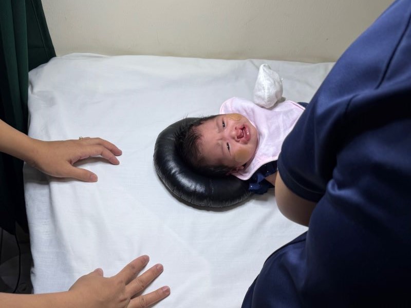 Infant check up appointment in preparation for the eventual reconstructive surgery